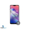 Screenshield ASUS Zenfone Max Pro (M2) ZB631KL folie na displej